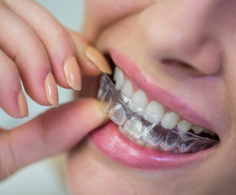 רופא שיניים מומחה לשיקום הפה